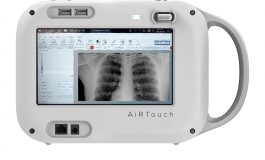 AiRTouch Portable X-Ray Receives FDA Clearance, Can Be Used for COVID Diagnosis