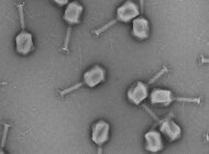 Bacteriophages to Diagnose and Treat Bladder Infections
