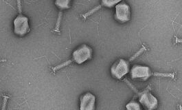 Bacteriophages to Diagnose and Treat Bladder Infections
