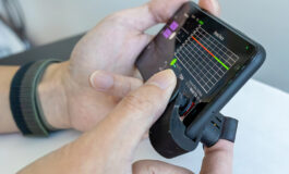 Low-Cost Smartphone Finger Clip Measures Blood Pressure