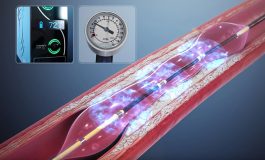 Cracking Calcium in Arteries Using Sound Waves: Interview with Shockwave Medical's Scott Shadiow