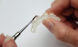 LightForce Orthodontics, Maker of 3D Printed Braces, Raises $14M Series B