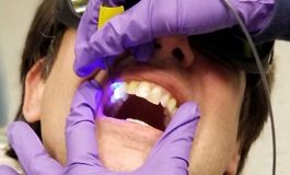 Optical Probe Measures Dental Plaque Acidity