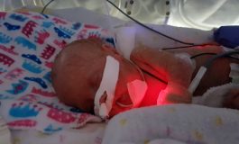 Extracellular Vesicles to Protect Lungs and Brain in Premature Birth
