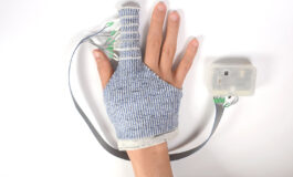 Knitted Glove Massages the Hand to Treat Edema
