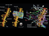Imaging Technique Reveals Living Brain Tissue in its Complexity