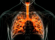 Nanoparticles Deliver mRNA Therapy to the Lungs