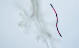 Magnetic Tentacle Robot Travels Deep into Lungs