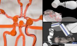 Telerobotic System Uses Magnets to Perform Endovascular Procedures