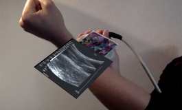 Augmented Reality Combined with Ultrasound Hints at Interesting Applications