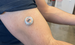 Wearable Uses Microneedles to Track Metabolism