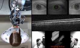 Robotic Scanner for Automated Eye Imaging